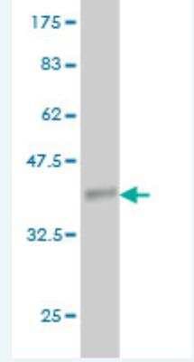 Western Blot: Angiopoietin-like Protein 7/ANGPTL7 Antibody (3F1) [H00010218-M05-100ug]