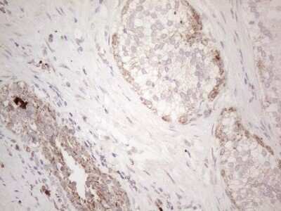 Immunohistochemistry: Angiopoietin-like protein 8/Betatrophin Antibody (OTI1B12) [NBP2-46596]