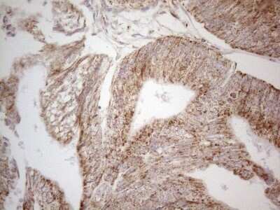 Immunohistochemistry: Angiopoietin-like protein 8/Betatrophin Antibody (OTI1B12) - Azide and BSA Free [NBP2-72046]