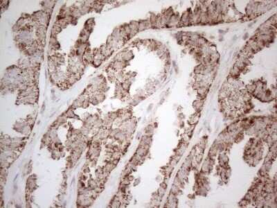 Immunohistochemistry: Angiopoietin-like protein 8/Betatrophin Antibody (OTI1B12) - Azide and BSA Free [NBP2-72046]
