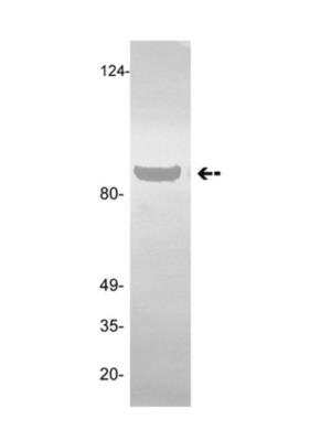 Western Blot: Angiostatin Antibody (GMA-013) [NBP2-29812]