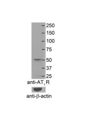 Western Blot: AGTR-1 Antibody [NBP1-59006]