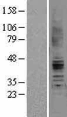 Western Blot: AGTR-2 Overexpression Lysate [NBL1-07397]