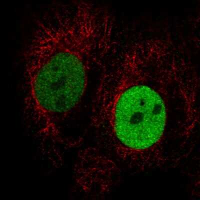Immunocytochemistry/ Immunofluorescence: Anillin Antibody (CL0303) [NBP2-52908]