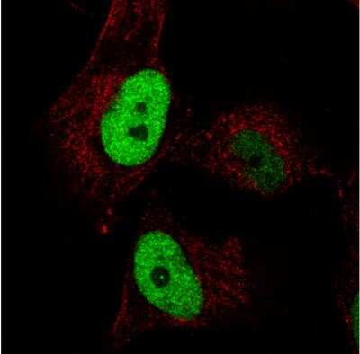 Immunocytochemistry/ Immunofluorescence: Anillin Antibody (CL0303) [NBP2-52908]