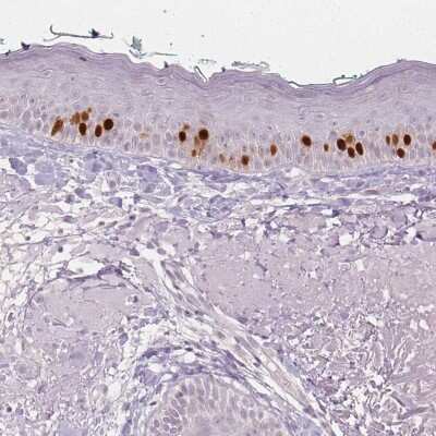 Immunohistochemistry-Paraffin: Anillin Antibody (CL0303) [NBP2-52908]