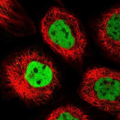 Immunocytochemistry/ Immunofluorescence: Anillin Antibody [NBP2-38630]