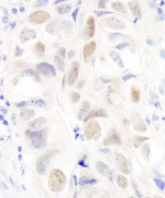 Immunohistochemistry: Anillin Antibody [NB100-68216]