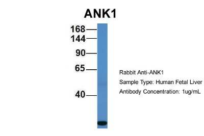 Western Blot: Ankyrin 1 Antibody [NBP1-55102]