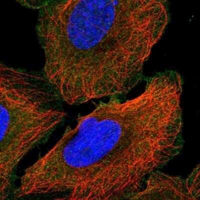 Immunocytochemistry/ Immunofluorescence: Ankyrin 3 Antibody [NBP2-58275]