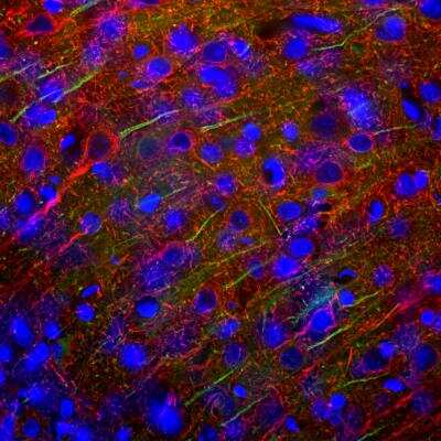 Immunocytochemistry/ Immunofluorescence: Ankyrin 3 Antibody [NBP3-05528]