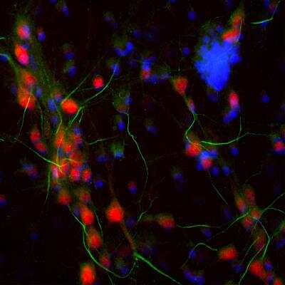 Immunocytochemistry/ Immunofluorescence: Ankyrin 3 Antibody [NBP3-05549]