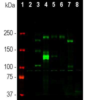 Western Blot: Ankyrin 3 Antibody [NBP3-05528]