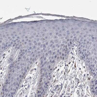 Immunohistochemistry-Paraffin: Ankyrin Brain Antibody [NBP2-33863]