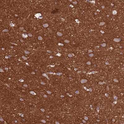 Immunohistochemistry-Paraffin: Ankyrin Brain Antibody [NBP2-34023]