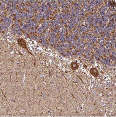 Immunohistochemistry-Paraffin: Ankyrin Repeat Domain 33B Antibody [NBP2-30975]