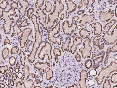 Immunohistochemistry-Paraffin: Ankyrin Repeat Domain 33B Antibody [NBP2-98013]