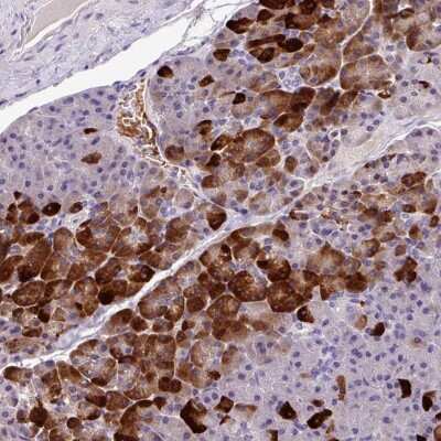Immunohistochemistry: Annexin 2 Receptor Antibody [NBP2-49008]