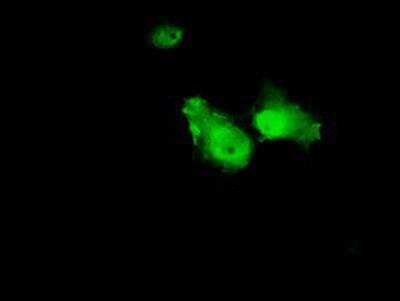 Immunocytochemistry/ Immunofluorescence: Annexin A1 Antibody (OTI3A8) [NBP2-02357]
