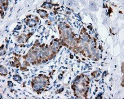 Immunohistochemistry-Paraffin: Annexin A1 Antibody (OTI3A8) [NBP2-02357]