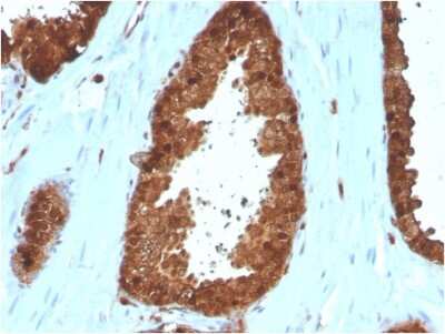 Immunohistochemistry-Paraffin: Annexin A1 Antibody (ANXA1/3566) [NBP3-07716]