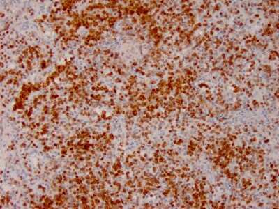 Immunohistochemistry-Paraffin: Annexin A1 Antibody (ANXA1/3566) [NBP3-07716]