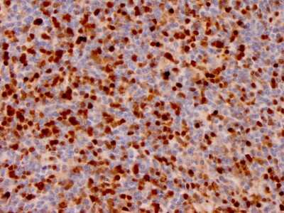Immunohistochemistry-Paraffin: Annexin A1 Antibody (ANXA1/3566) [NBP3-07716]