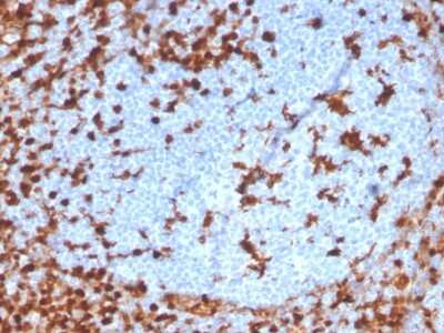 Immunohistochemistry-Paraffin: Annexin A1 Antibody (ANXA1/3869R) - Azide and BSA Free [NBP3-08709]