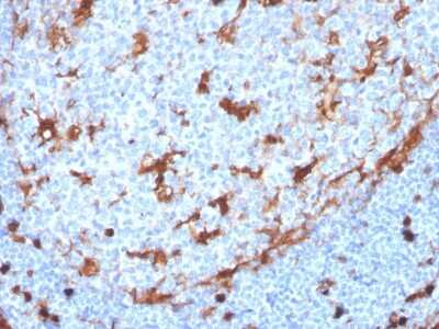 Immunohistochemistry-Paraffin: Annexin A1 Antibody (ANXA1/3869R) - Azide and BSA Free [NBP3-08709]