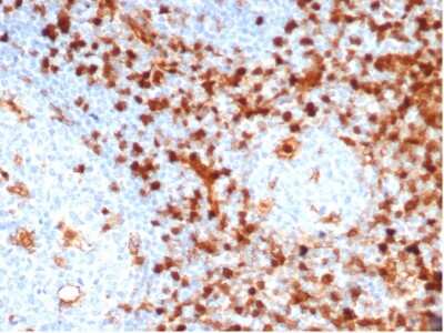 Immunohistochemistry-Paraffin: Annexin A1 Antibody (ANXA1/6452R) [NBP3-13935]