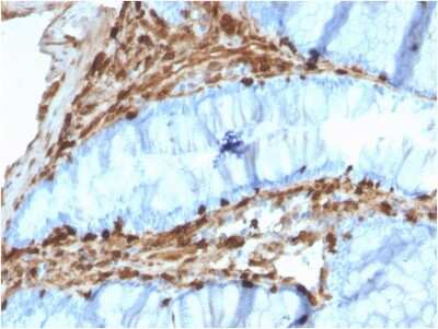 Immunohistochemistry-Paraffin: Annexin A1 Antibody (CPTC-ANXA1-1) [NBP3-07714]