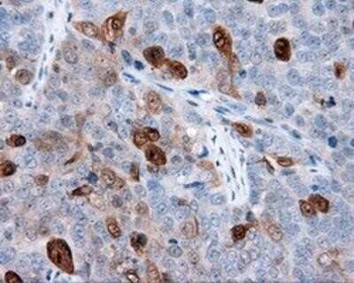 Immunohistochemistry: Annexin A1 Antibody (OTI3A8) - Azide and BSA Free [NBP2-70174]