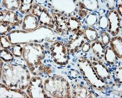 Immunohistochemistry-Paraffin: Annexin A10 Antibody (OTI4D8) [NBP2-02282]