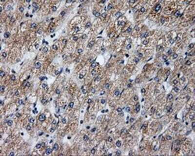 Immunohistochemistry-Paraffin: Annexin A10 Antibody (OTI4D8) [NBP2-02282]