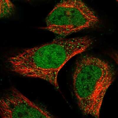 Immunocytochemistry/ Immunofluorescence: Annexin A11 Antibody [NBP1-90160]