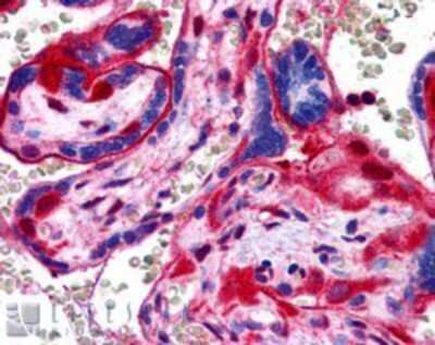 Immunohistochemistry-Paraffin: Annexin A11 Antibody [NB300-875]