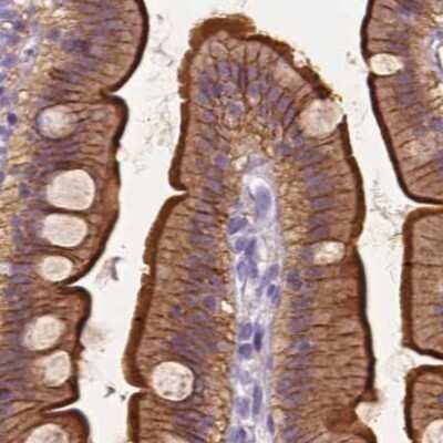 Immunohistochemistry-Paraffin: Annexin A13 Antibody [NBP1-90157]