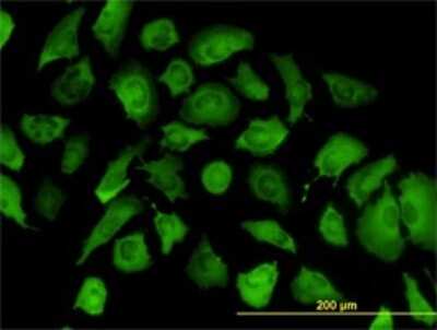Immunocytochemistry/ Immunofluorescence: Annexin A2 Antibody (1G7) [H00000302-M02]
