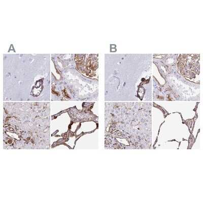 Immunohistochemistry-Paraffin: Annexin A2 Antibody [NBP2-62638]