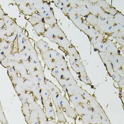 Immunohistochemistry-Paraffin: Annexin A2 Antibody - BSA Free [NBP2-92959]