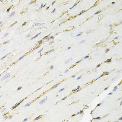 Immunohistochemistry-Paraffin: Annexin A2 Antibody - BSA Free [NBP2-92959]