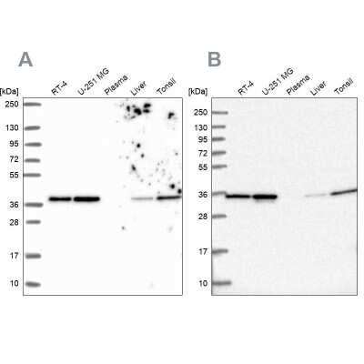 Western Blot: Annexin A2 Antibody [NBP2-62638]