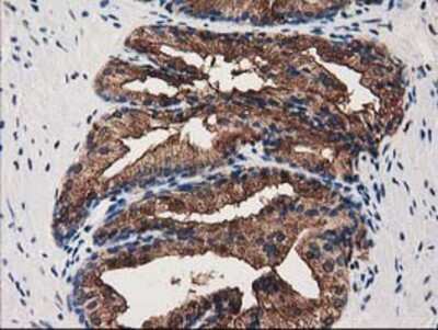 Immunohistochemistry-Paraffin: Annexin A3 Antibody (OTI1A5) [NBP2-03374]