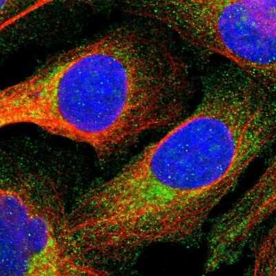 Immunocytochemistry/ Immunofluorescence: Annexin A3 Antibody [NBP1-90155]