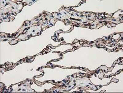 Immunohistochemistry: Annexin A3 Antibody (OTI1A5) - Azide and BSA Free [NBP2-70179]