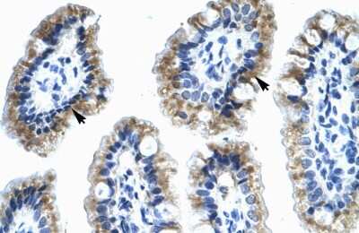 Immunohistochemistry: Annexin A4 Antibody [NBP1-59120]