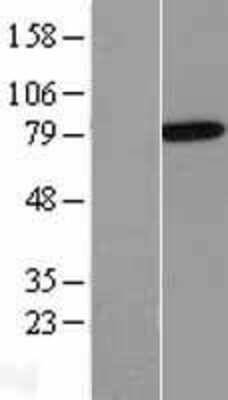 Western Blot: Annexin A6 Overexpression Lysate [NBL1-07566]