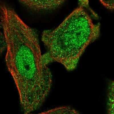 Immunocytochemistry/ Immunofluorescence: Annexin A7 Antibody [NBP2-57620]