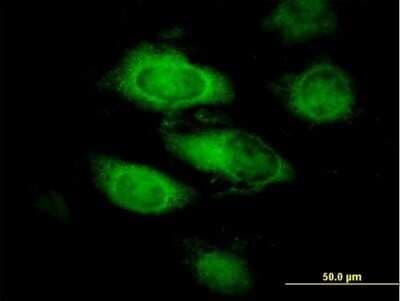Immunocytochemistry/ Immunofluorescence: Annexin A9 Antibody [H00008416-B01P]