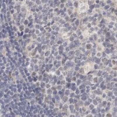 Immunohistochemistry-Paraffin: Annexin A9 Antibody [NBP1-90153]